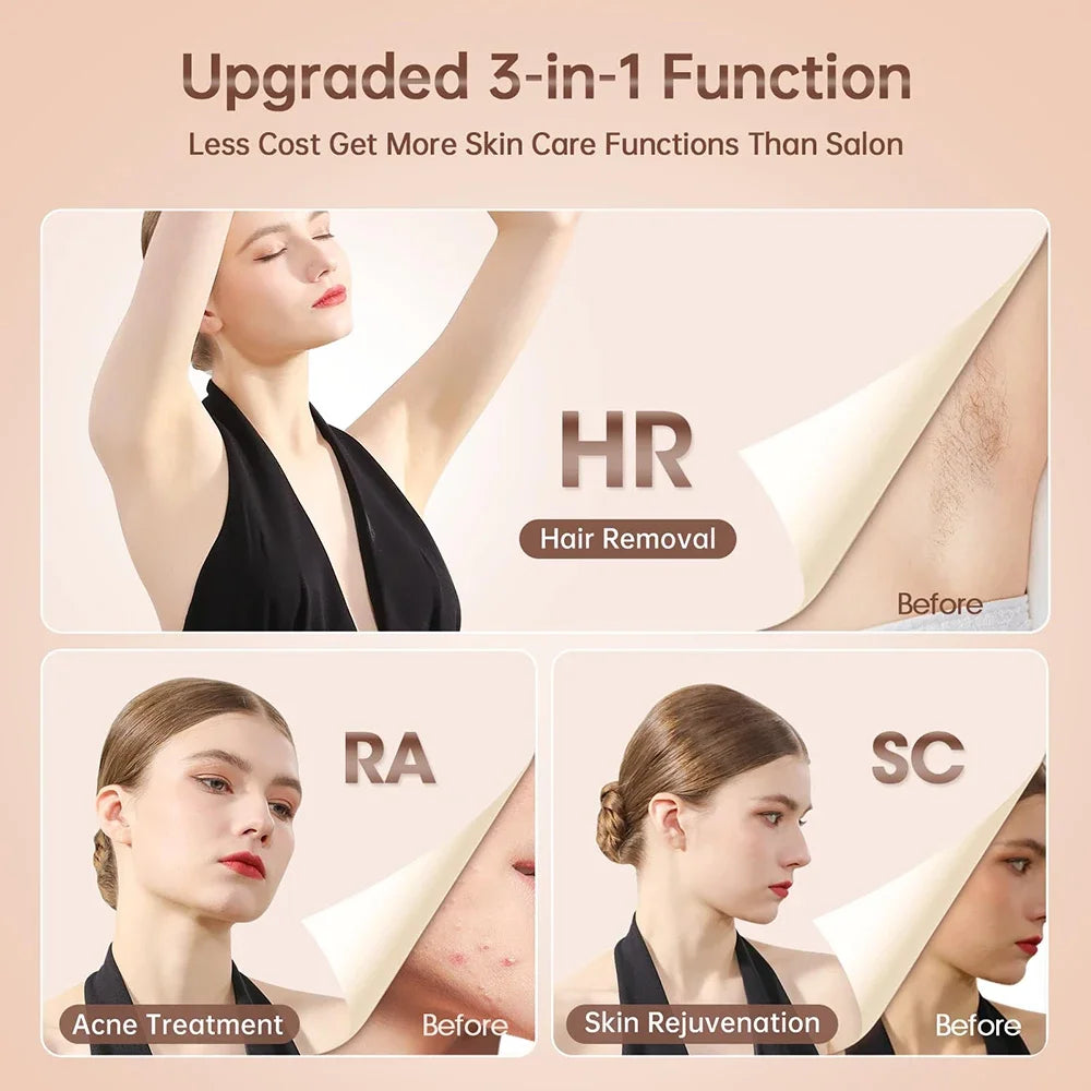 IPL Laser Hair Removal Device - 999,900 Flashes for Permanent Use